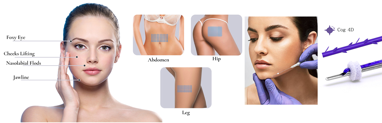 PDO Cog 4D Facial Lift: Levantamiento de hilo avanzado para el contorno de la mandíbula