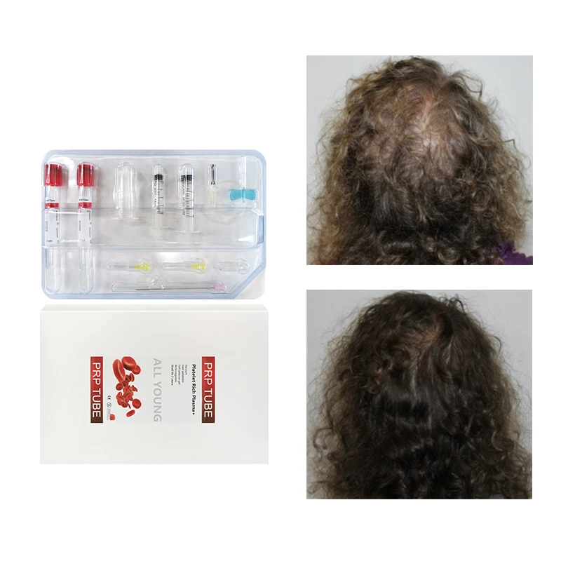 Kit de tubos de PRP con biotina en gel ACD coreano de 15 ml