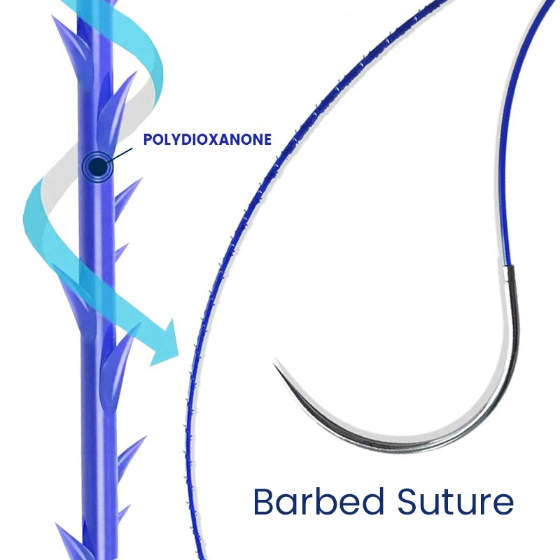 Suturas quir&uacute;rgicas absorbibles