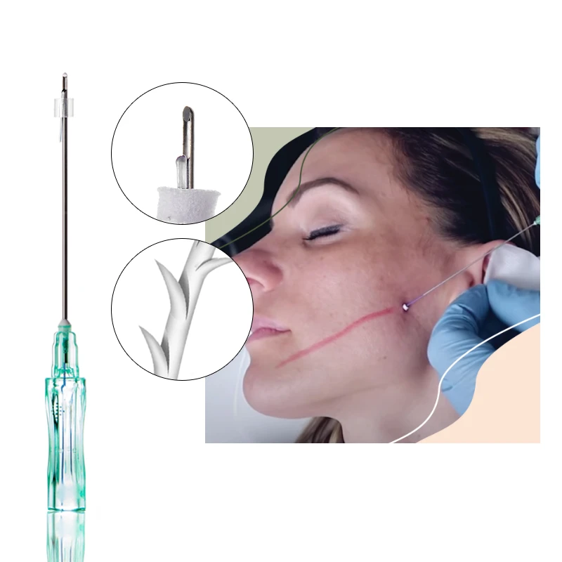 Hilo de moldeo PCL 18G 19G 100 mm para contorno facial