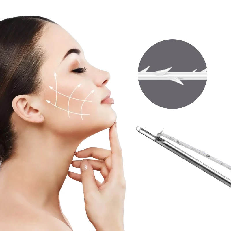 Hilos PCL Cog 6D Hilos de p&uacute;as fuertes para estiramiento facial
